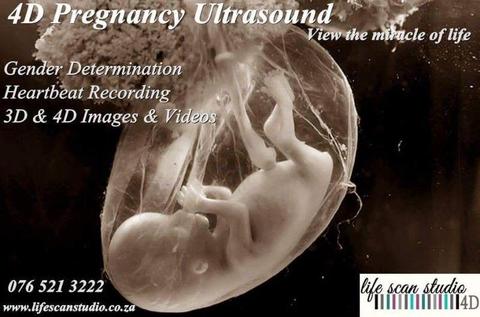 4D Pregnancy ultrasound