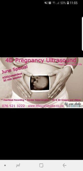 4D Pregnancy ultrasound