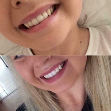 Whitening toothpaste