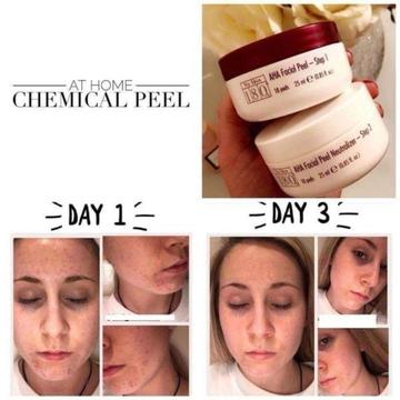 AHA Facial Peel // Removes blemishes, breakouts and many more.. AMAZING results