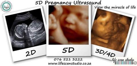 5D pregnancy ultrasound